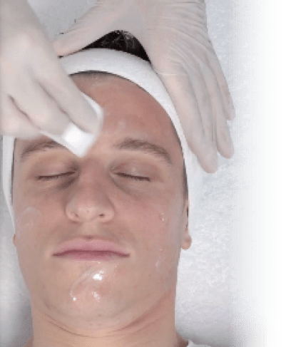 Peeling Eneomey Application Prepeel